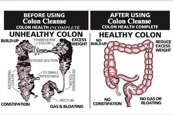 Colon Cleansing Kolonics 