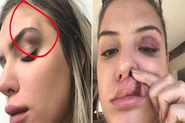 FaZe's girlfriend Alissa assaulted by Barley house worker