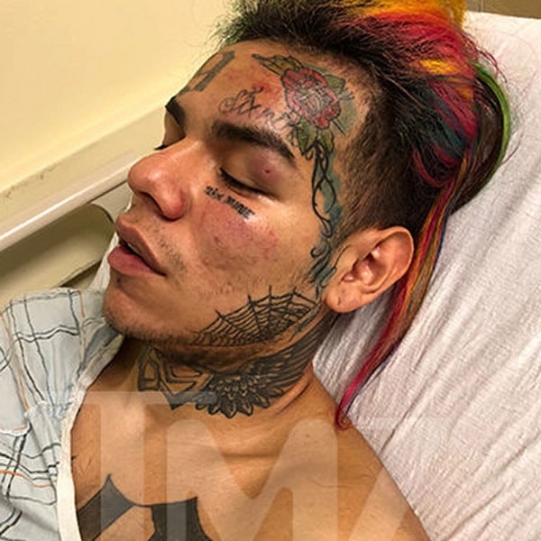 Tekashi69 is badly injured