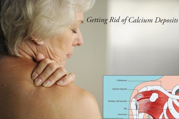 10 Ways How To Get Rid Of Calcium Deposits