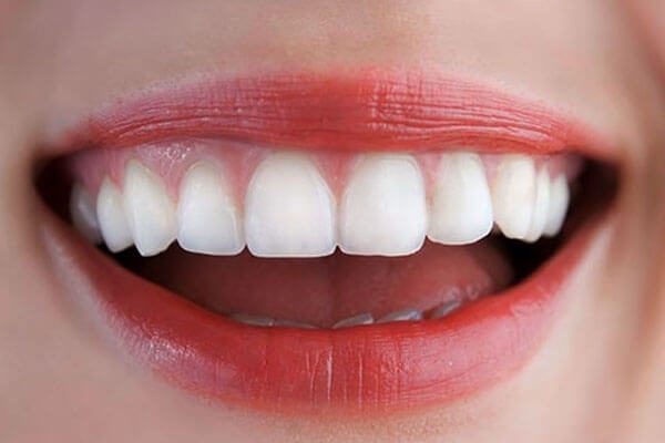 Teeth-in-a-day Dental implant