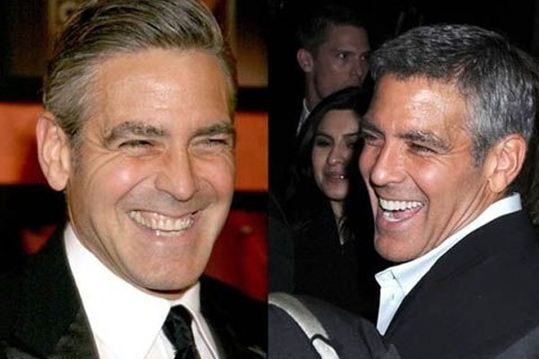 George Clooney Teeth