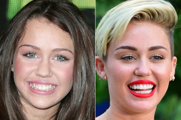 Miley Cyrus teeth