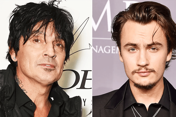 Tommy Lee’s Son Punched and left him bloodied with a fat lip